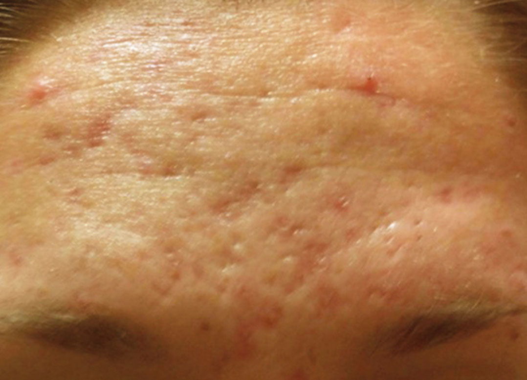 Before image