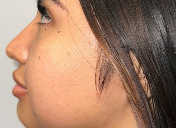 Frame 1321314588