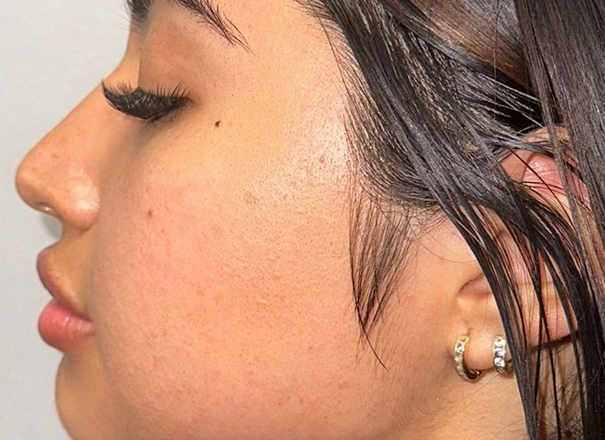 five tips for great skin