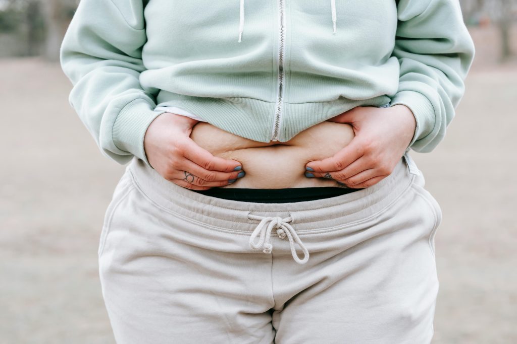 Overweight woman holding her belly