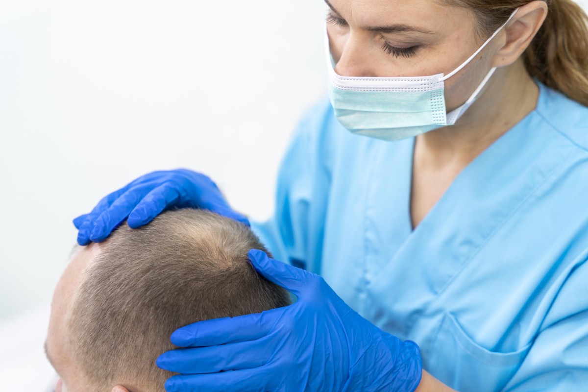 mature-man-having-balding-problems